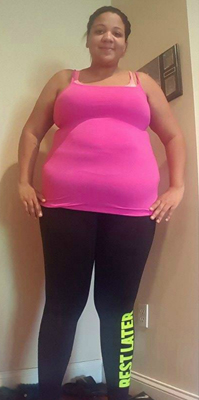 Chrissy before picture