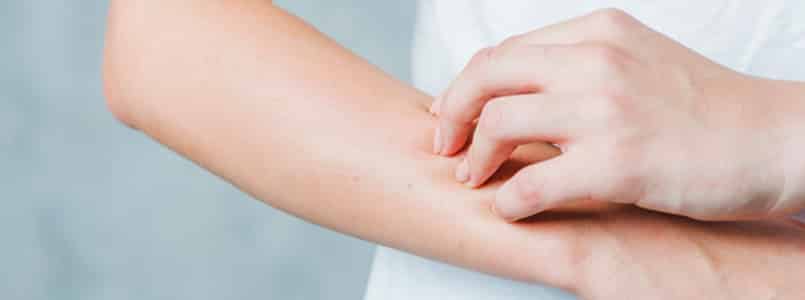 Woman scratching her forearm