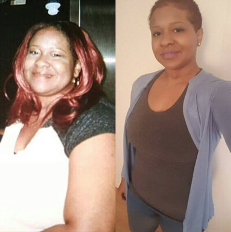 Mayling before and after