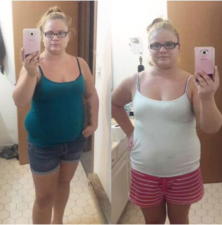 Stevie before and after