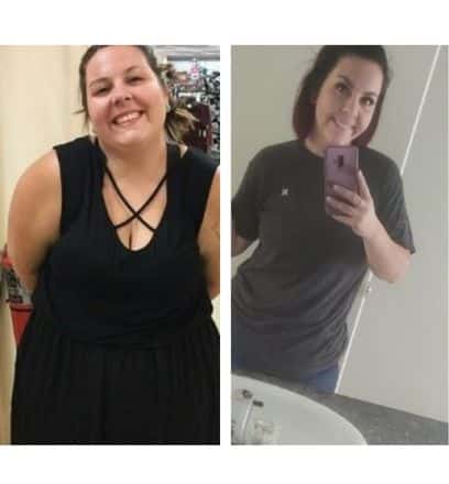 Chelc before and after